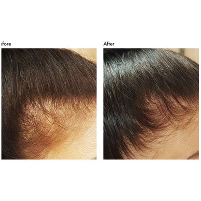 Hair Gain Hair Mask Nourishing Miracle Treatment for Your Hair Growth